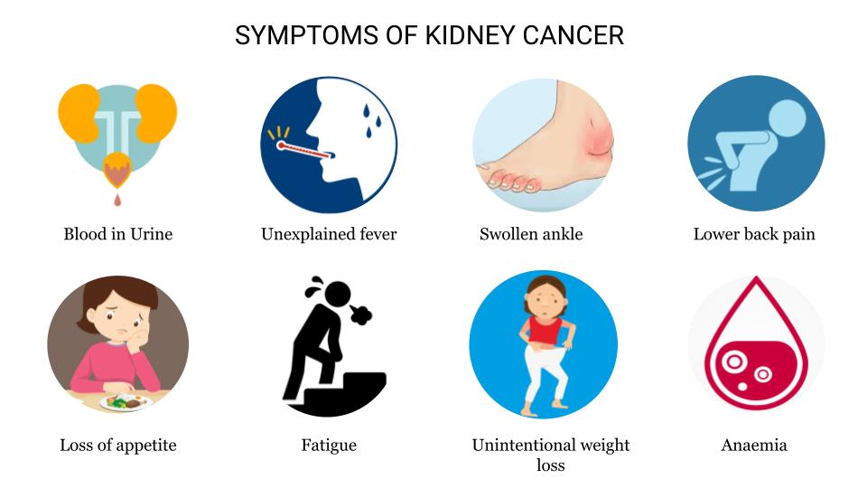 Kidney cancer is mostly asymptomatic in its early stages and it only